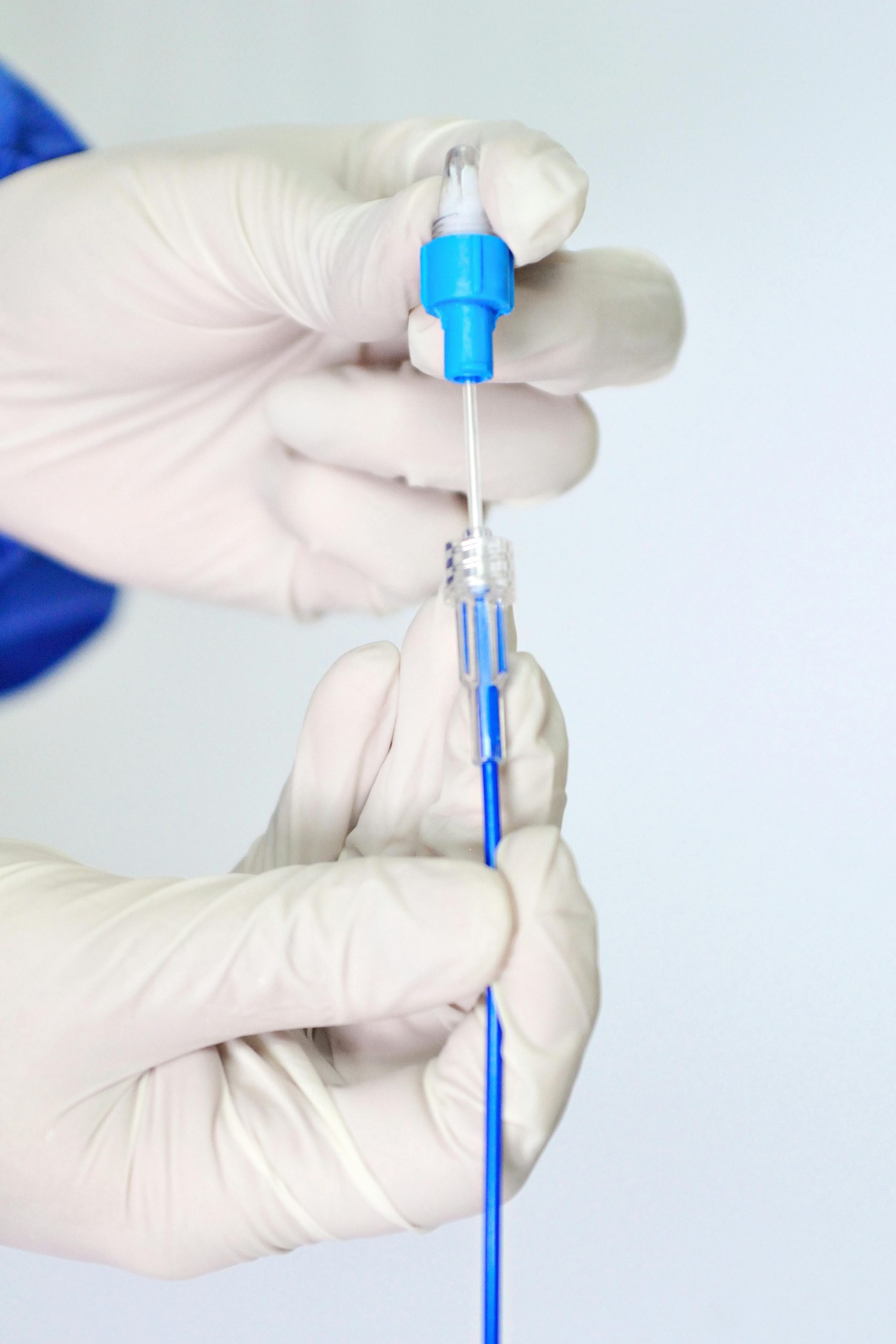 Stent et impact sur la longévité - données scientifiques