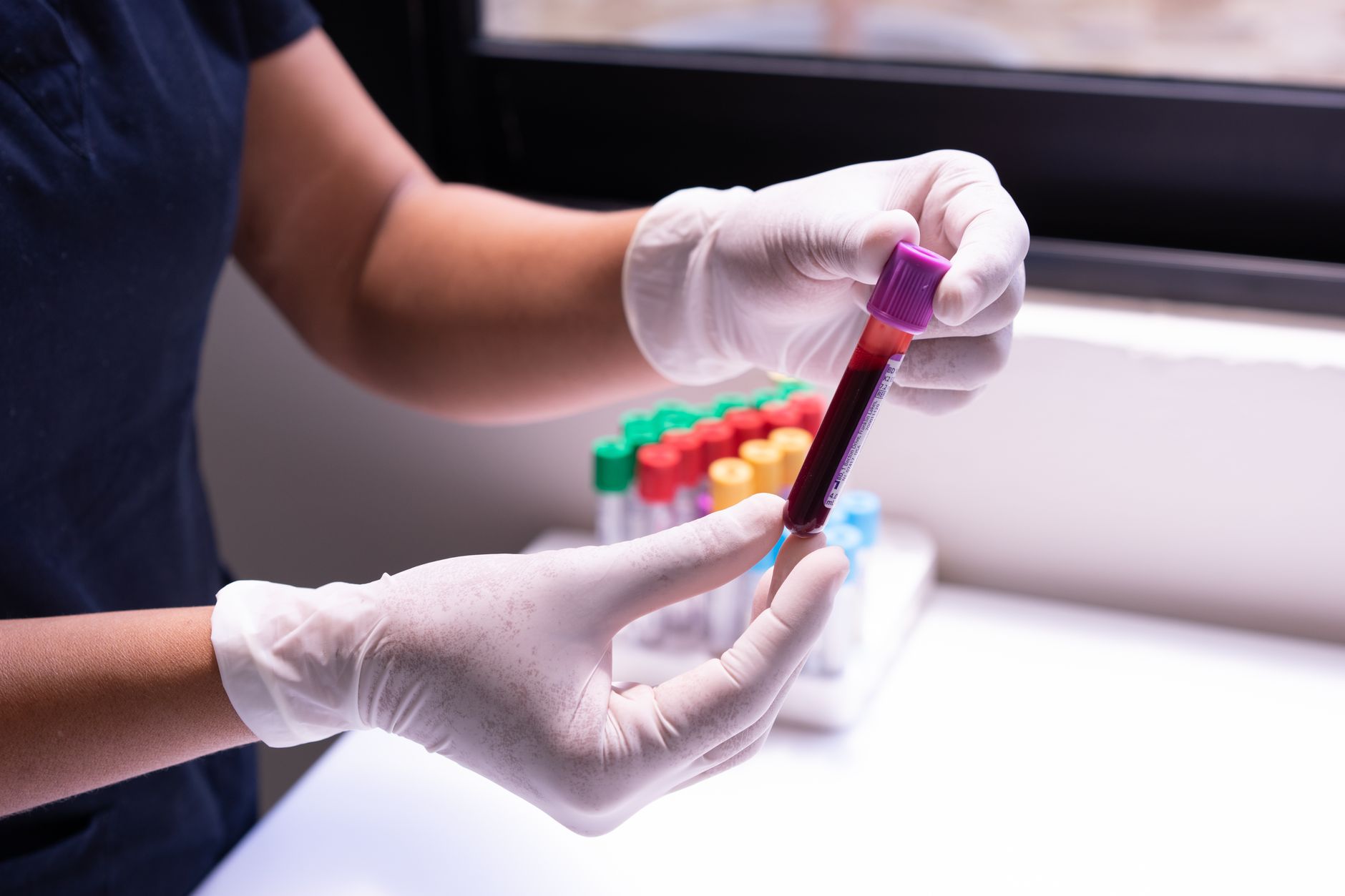 Prise de sang pour doser la prolactine